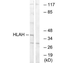 Western Blot - Anti-HLAH Antibody (C16165) - Antibodies.com