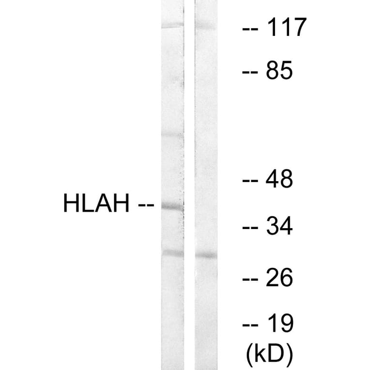 Western Blot - Anti-HLAH Antibody (C16165) - Antibodies.com