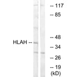 Western Blot - Anti-HLAH Antibody (C16165) - Antibodies.com