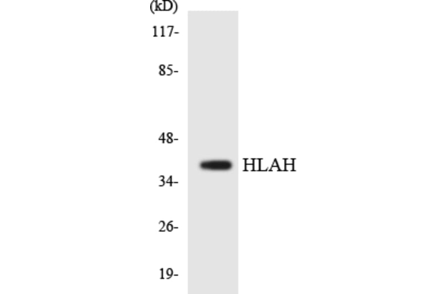 Western Blot - Anti-HLAH Antibody (R12-2882) - Antibodies.com
