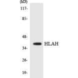 Western Blot - Anti-HLAH Antibody (R12-2882) - Antibodies.com