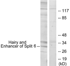 Western Blot - Anti-HES6 Antibody (C11496) - Antibodies.com