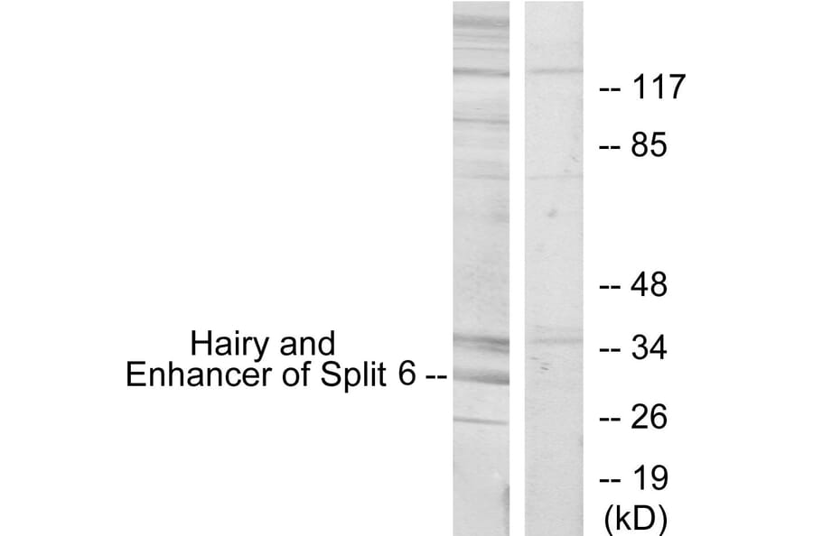 Western Blot - Anti-HES6 Antibody (C11496) - Antibodies.com