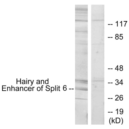Western Blot - Anti-HES6 Antibody (C11496) - Antibodies.com