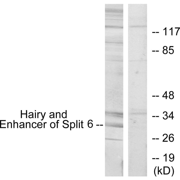 Western Blot - Anti-HES6 Antibody (C11496) - Antibodies.com