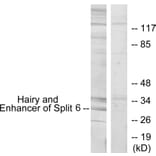 Western Blot - Anti-HES6 Antibody (C11496) - Antibodies.com