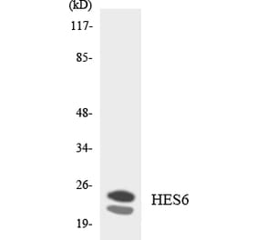 Western Blot - Anti-HES6 Antibody (R12-2874) - Antibodies.com