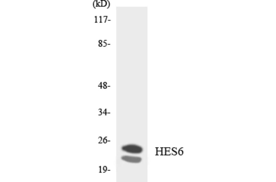 Western Blot - Anti-HES6 Antibody (R12-2874) - Antibodies.com