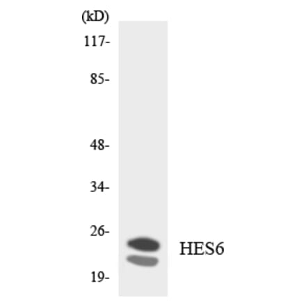 Western Blot - Anti-HES6 Antibody (R12-2874) - Antibodies.com