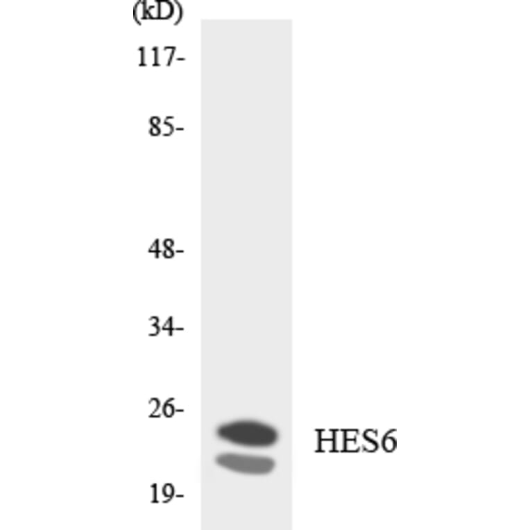 Western Blot - Anti-HES6 Antibody (R12-2874) - Antibodies.com