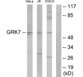 Western Blot - Anti-GRK7 Antibody (C11400) - Antibodies.com