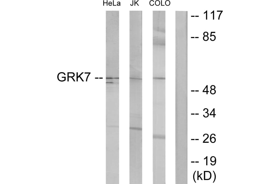 Western Blot - Anti-GRK7 Antibody (C11400) - Antibodies.com