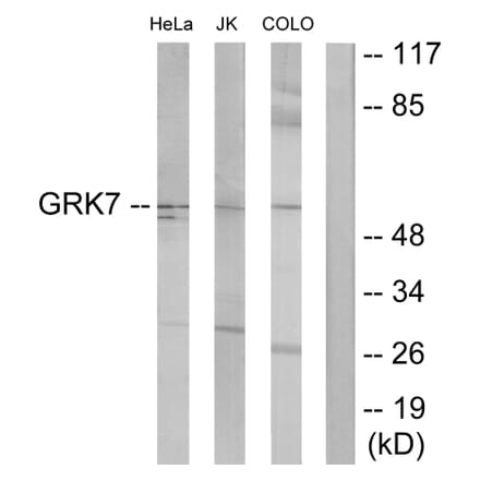 Western Blot - Anti-GRK7 Antibody (C11400) - Antibodies.com