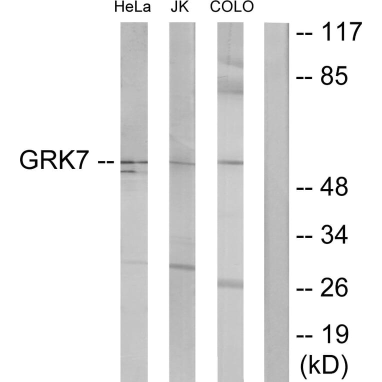 Western Blot - Anti-GRK7 Antibody (C11400) - Antibodies.com