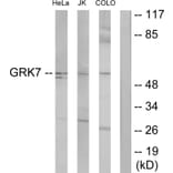 Western Blot - Anti-GRK7 Antibody (C11400) - Antibodies.com