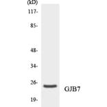 Western Blot - Anti-GJB7 Antibody (R12-2812) - Antibodies.com