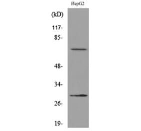 Western Blot - Anti-GGT1 Antibody (C30439) - Antibodies.com