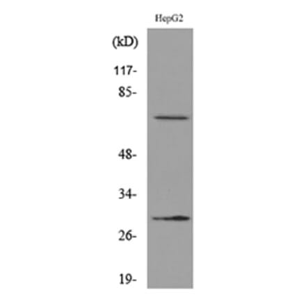 Western Blot - Anti-GGT1 Antibody (C30439) - Antibodies.com