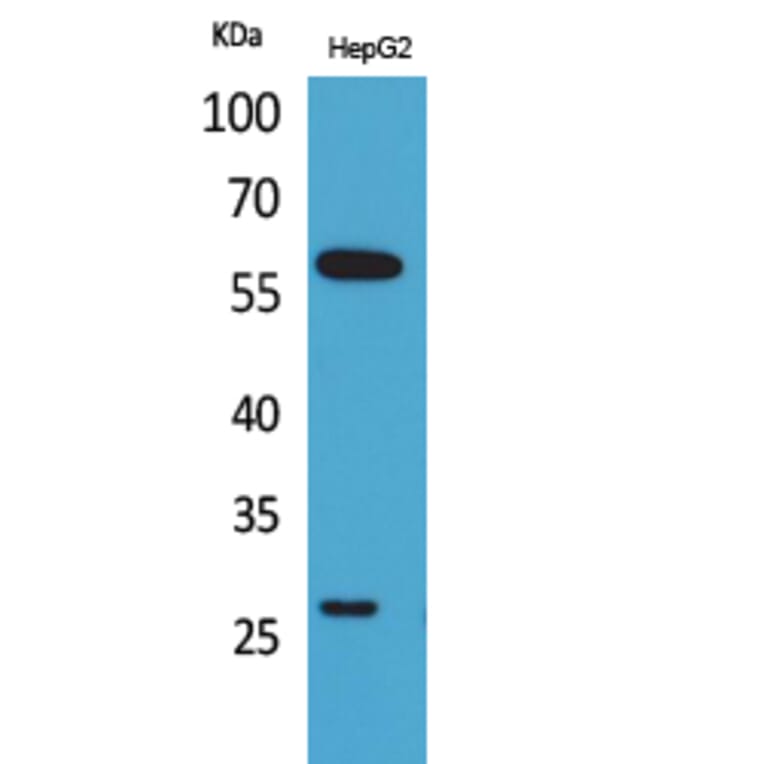Western Blot - Anti-GGT1 Antibody (C30439) - Antibodies.com