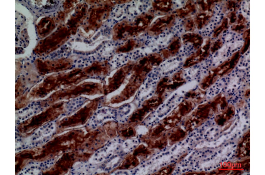 Immunohistochemistry - Anti-GGT1 Antibody (C30439) - Antibodies.com