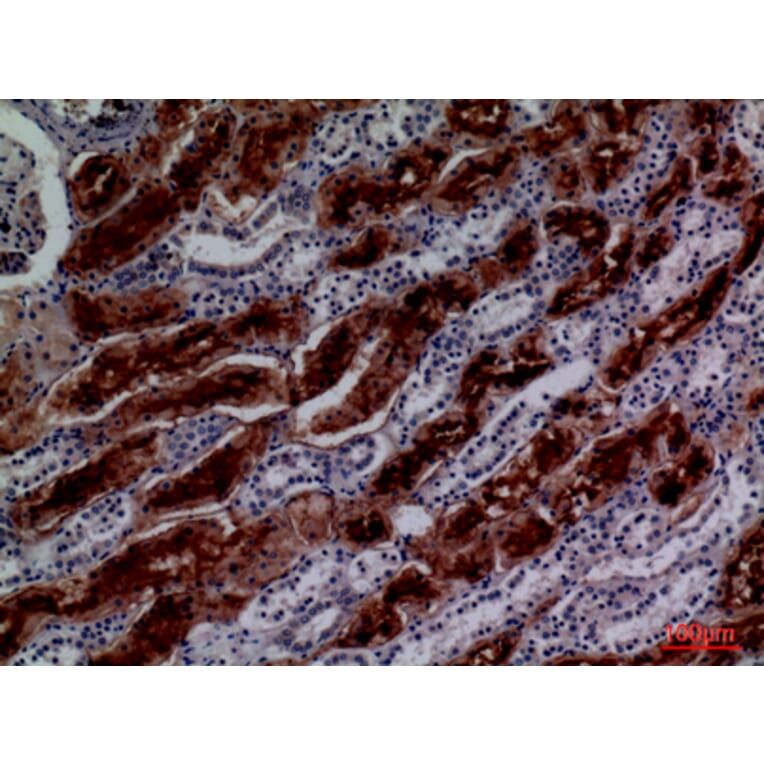 Immunohistochemistry - Anti-GGT1 Antibody (C30439) - Antibodies.com