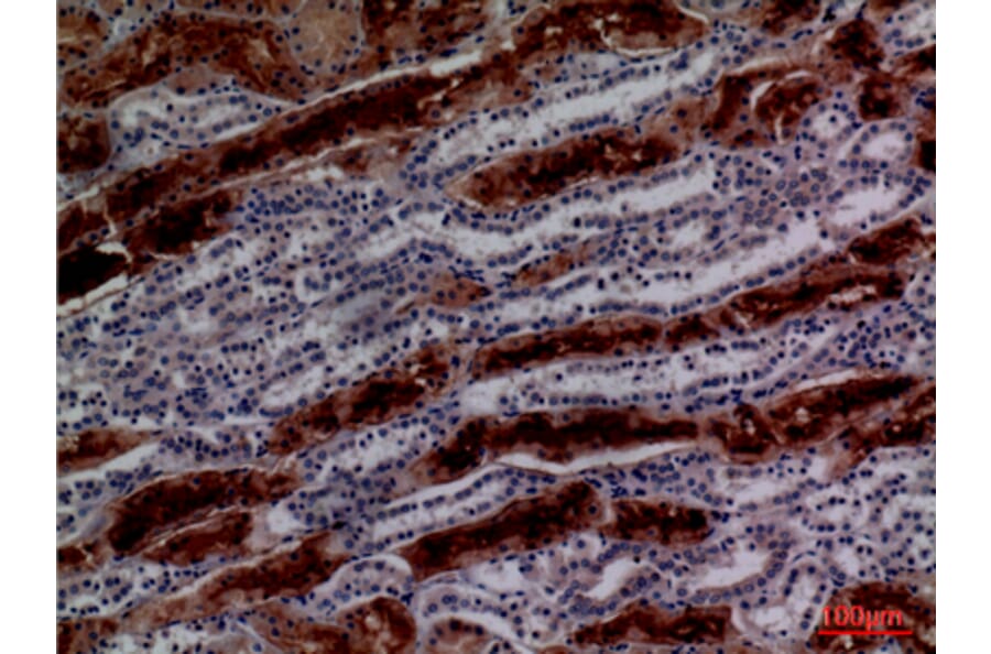 Immunohistochemistry - Anti-GGT1 Antibody (C30439) - Antibodies.com