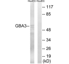 Western Blot - Anti-GBA3 Antibody (C15299) - Antibodies.com