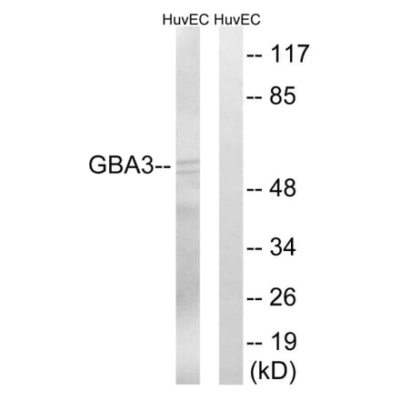 Western Blot - Anti-GBA3 Antibody (C15299) - Antibodies.com