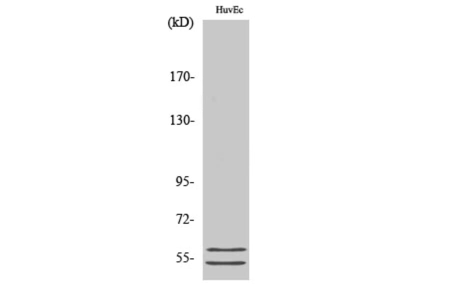Western Blot - Anti-GBA3 Antibody (C15299) - Antibodies.com