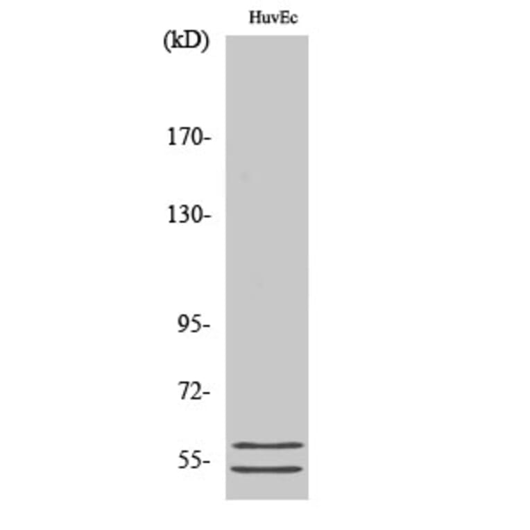 Western Blot - Anti-GBA3 Antibody (C15299) - Antibodies.com