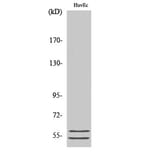 Western Blot - Anti-GBA3 Antibody (C15299) - Antibodies.com