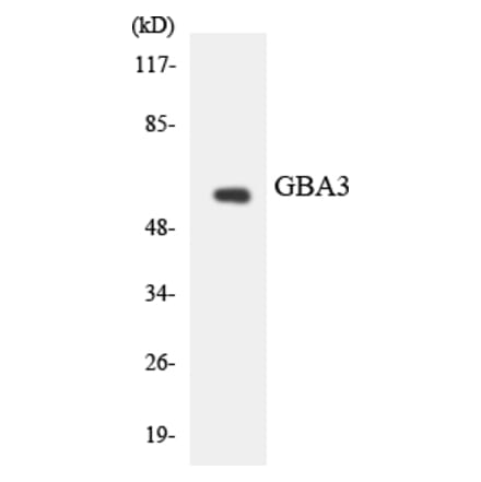 Western Blot - Anti-GBA3 Antibody (R12-2801) - Antibodies.com