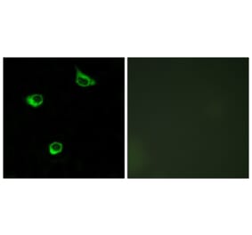 Immunofluorescence - Anti-FZD6 Antibody (G111) - Antibodies.com