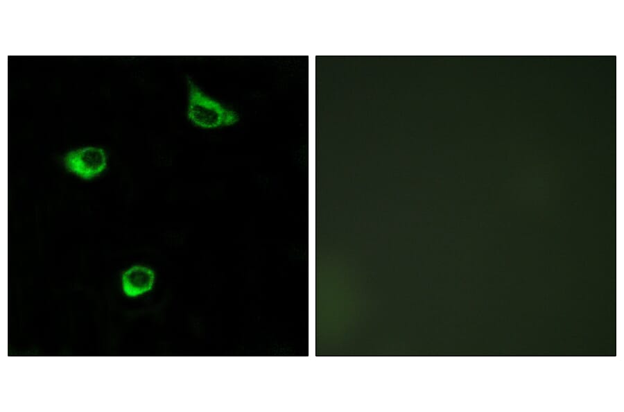 Immunofluorescence - Anti-FZD6 Antibody (G111) - Antibodies.com