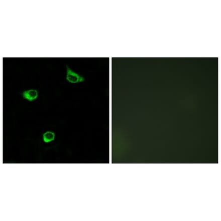 Immunofluorescence - Anti-FZD6 Antibody (G111) - Antibodies.com