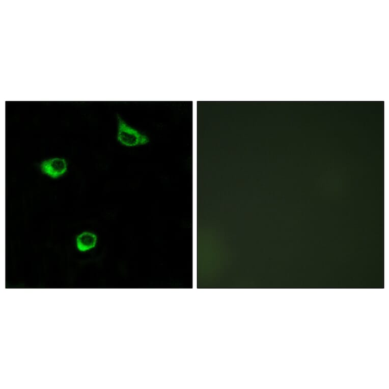 Immunofluorescence - Anti-FZD6 Antibody (G111) - Antibodies.com