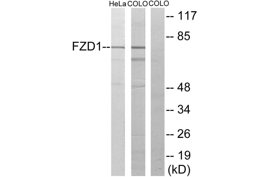 Western Blot - Anti-FZD1 Antibody (G105) - Antibodies.com