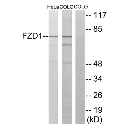 Western Blot - Anti-FZD1 Antibody (G105) - Antibodies.com