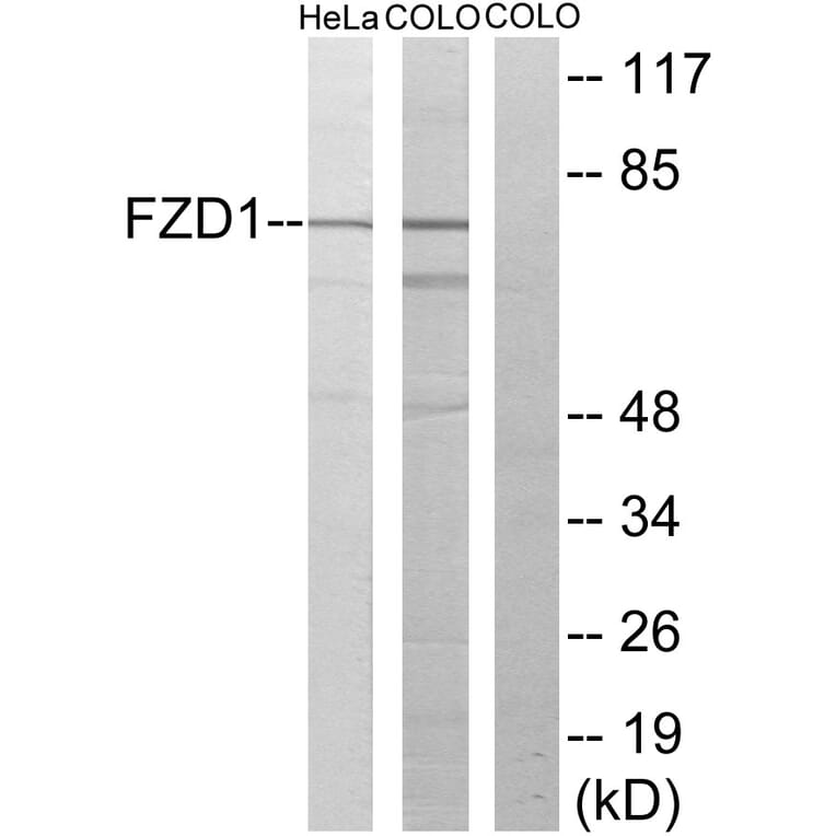 Western Blot - Anti-FZD1 Antibody (G105) - Antibodies.com