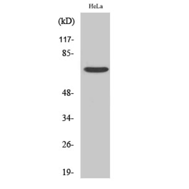 Western Blot - Anti-FZD1 Antibody (G105) - Antibodies.com