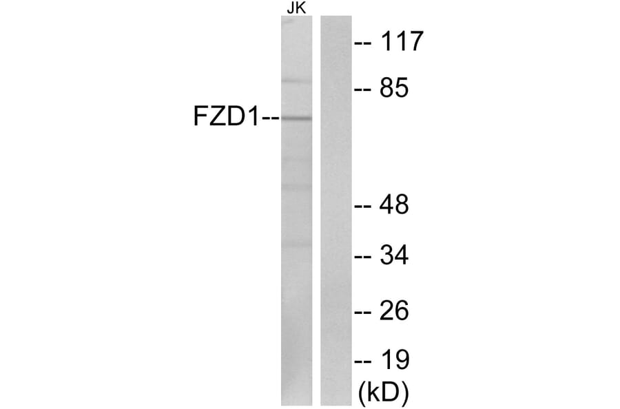 Western Blot - Anti-FZD1 Antibody (G254) - Antibodies.com
