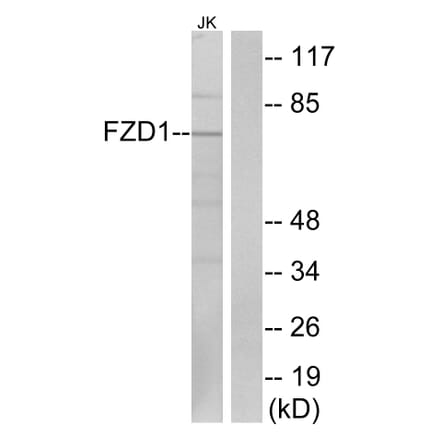 Western Blot - Anti-FZD1 Antibody (G254) - Antibodies.com