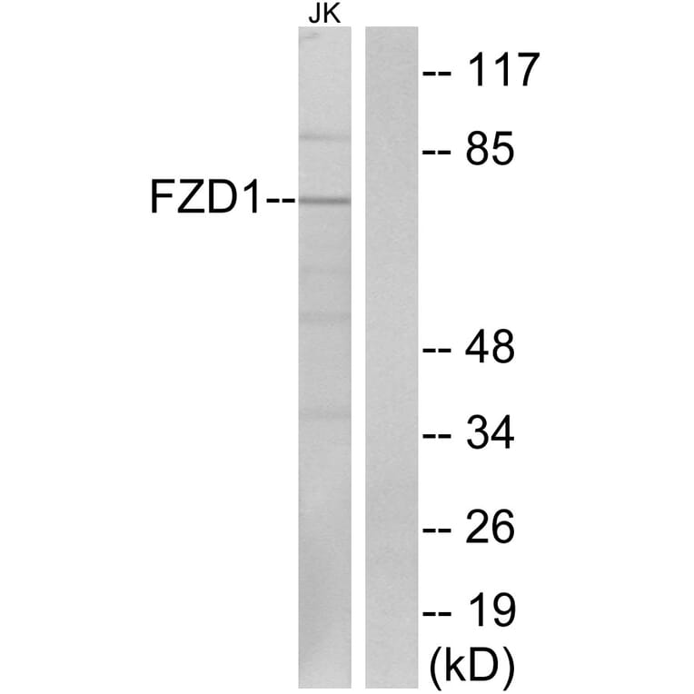 Western Blot - Anti-FZD1 Antibody (G254) - Antibodies.com