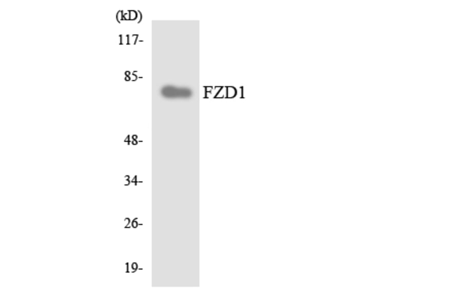 Western Blot - Anti-FZD1 Antibody (R12-2782) - Antibodies.com