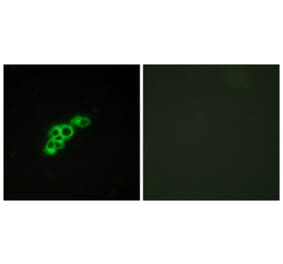 Immunofluorescence - Anti-FSHR Antibody (G101) - Antibodies.com