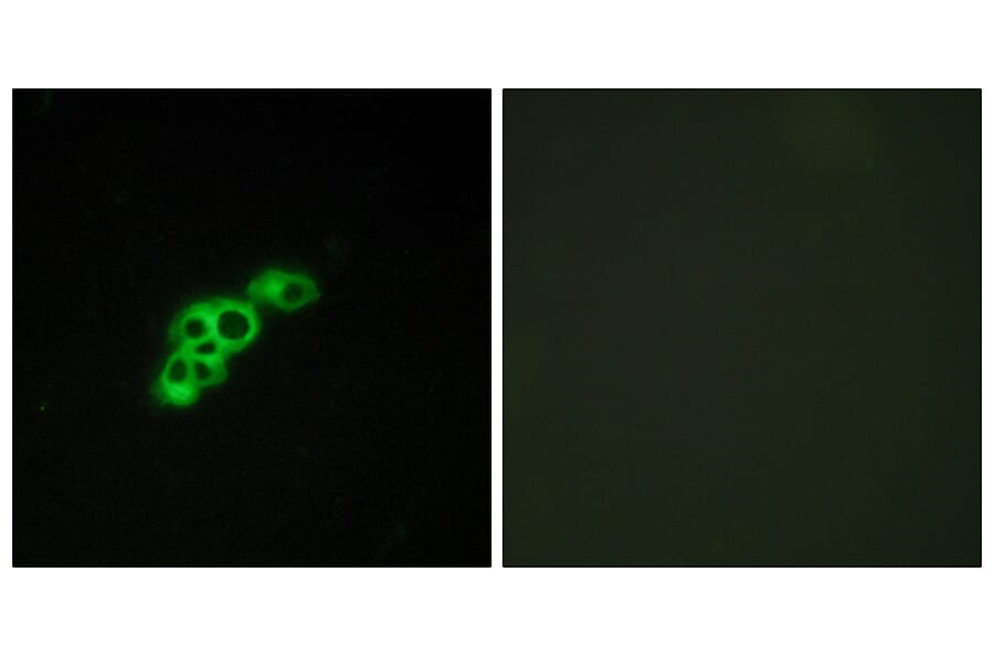 Immunofluorescence - Anti-FSHR Antibody (G101) - Antibodies.com