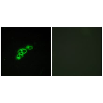 Immunofluorescence - Anti-FSHR Antibody (G101) - Antibodies.com