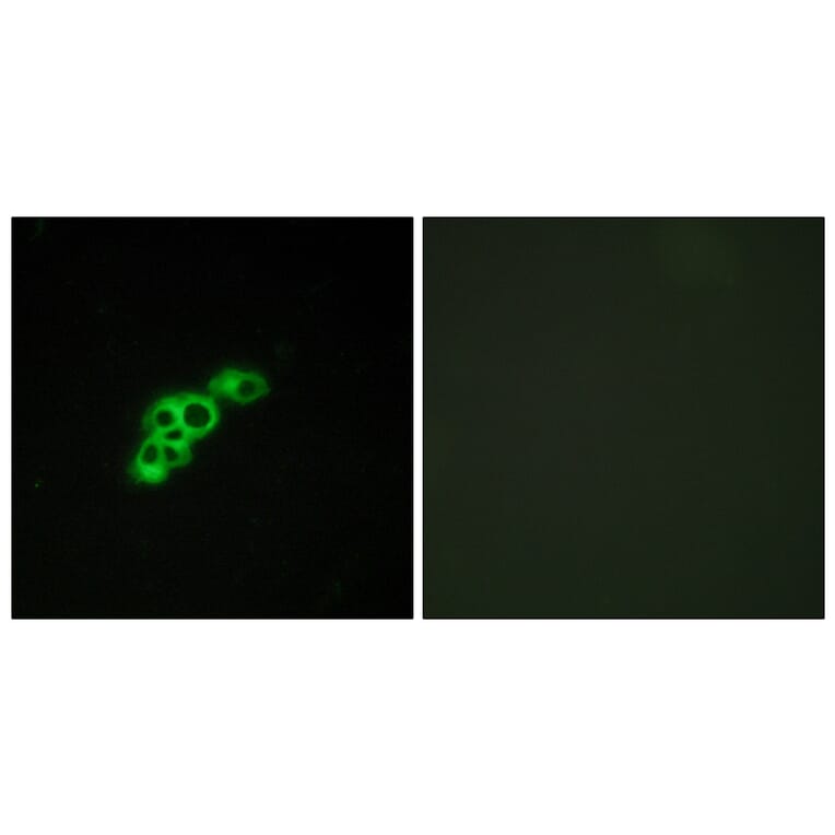 Immunofluorescence - Anti-FSHR Antibody (G101) - Antibodies.com