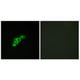 Immunofluorescence - Anti-FSHR Antibody (G101) - Antibodies.com