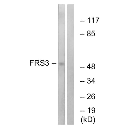 Western Blot - Anti-FRS3 Antibody (C12384) - Antibodies.com